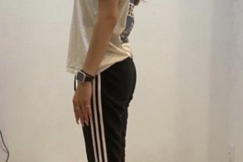 30代女性　アフター写真