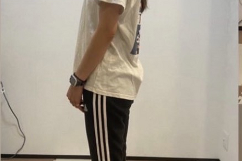 30代女性　ビフォー写真